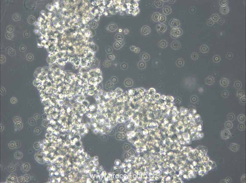 OCI-Ly3 (人弥漫大 B 细胞淋巴瘤细胞) (STR鉴定正确)