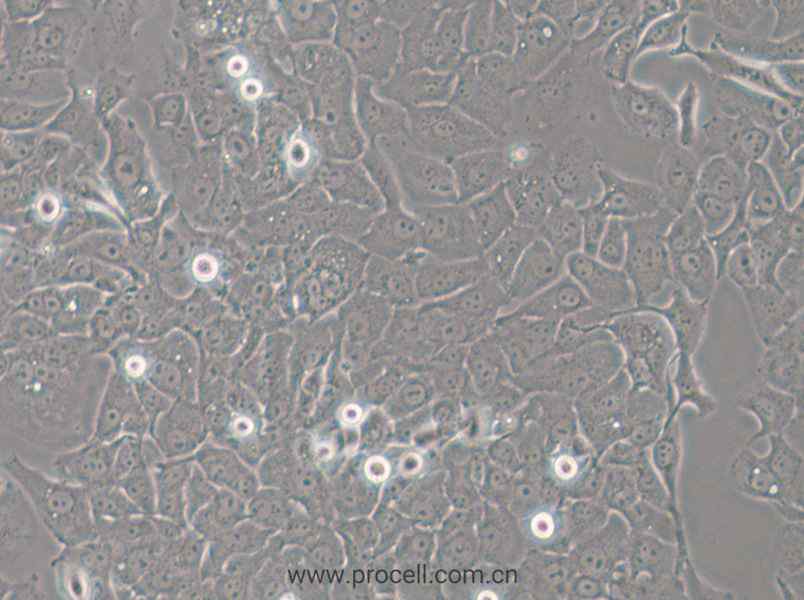 HCC4006 (人肺癌腺癌细胞) (STR鉴定正确)