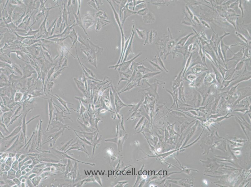 NCI-H1648 (人肺癌腺癌细胞) (STR鉴定正确)