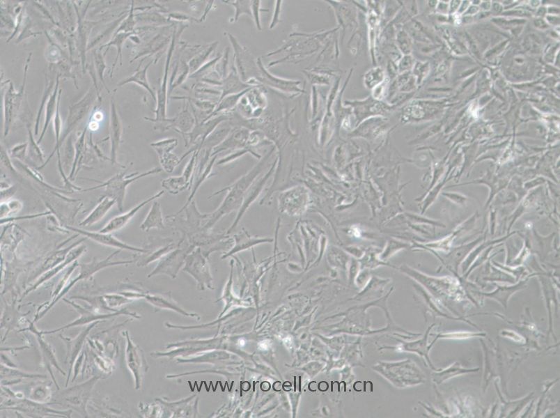 NCI-H1648 (人肺癌腺癌细胞) (STR鉴定正确)