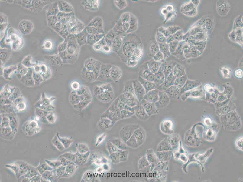 HCC1428 (人乳腺腺癌细胞) (STR鉴定正确)