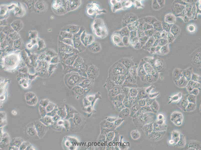 HCC1428 (人乳腺腺癌细胞) (STR鉴定正确)