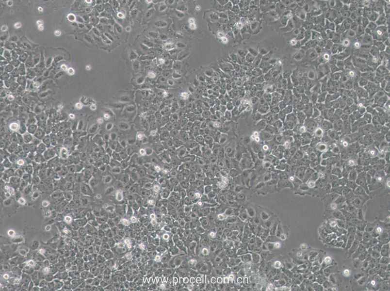 SACC-83 (人涎腺腺样囊性癌细胞) (STR鉴定正确)