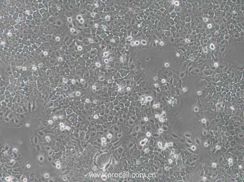 SACC-83 (人涎腺腺样囊性癌细胞) (STR鉴定正确)