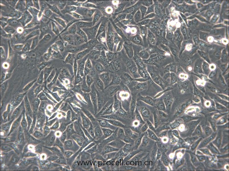 HS-5 (人骨髓基质细胞) (STR鉴定正确)