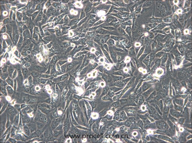 HS-5 (人骨髓基质细胞) (STR鉴定正确)