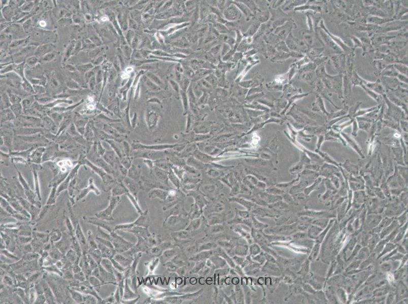 OCUT-2C (人甲状腺癌细胞（未分化）) (STR鉴定正确)