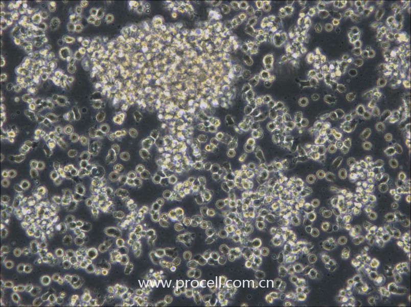 HCC38 BL (人淋巴母细胞（EBV 转化）) (STR鉴定正确)