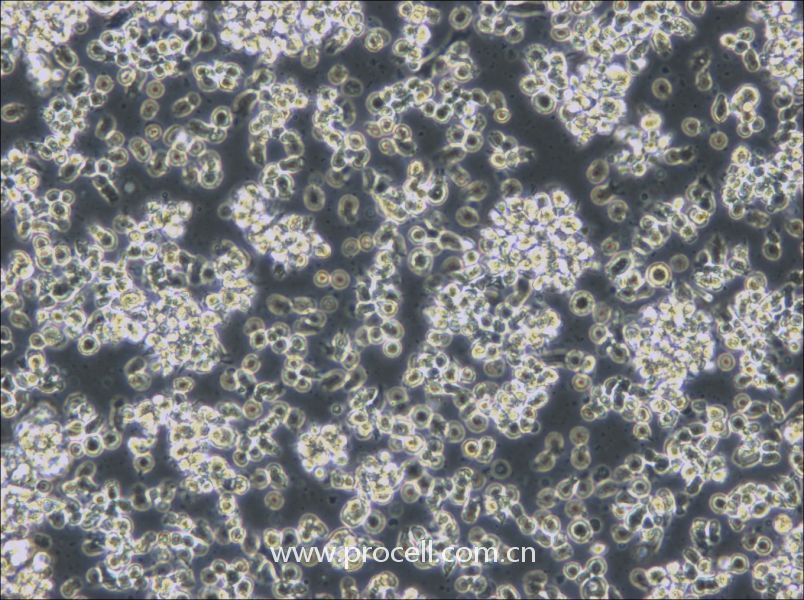 HCC38 BL (人淋巴母细胞（EBV 转化）) (STR鉴定正确)