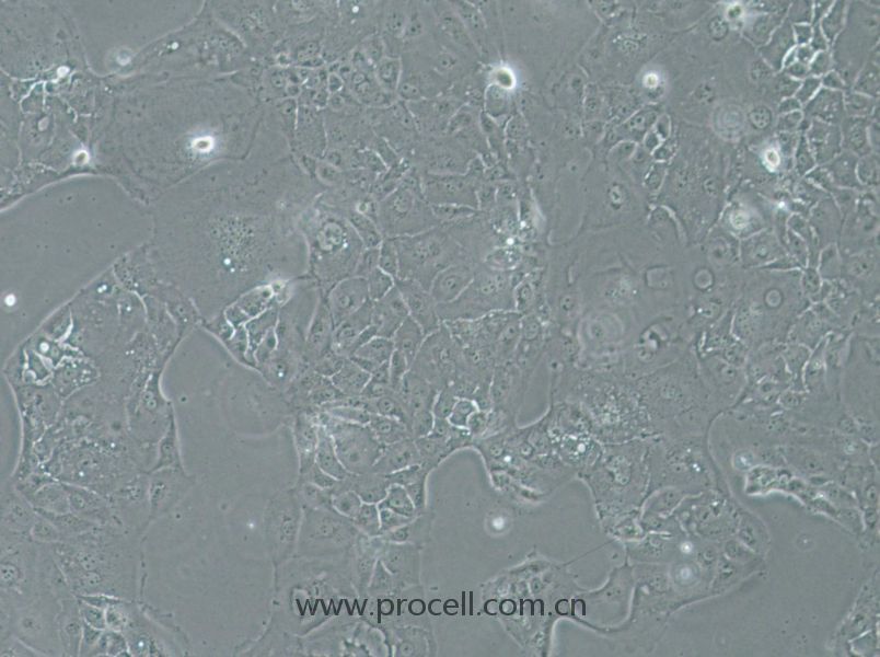 SU.86.86 (人胰腺导管癌细胞) (STR鉴定正确)