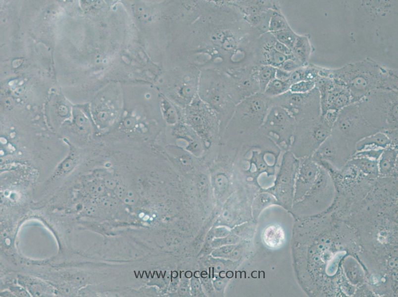 SU.86.86 (人胰腺导管癌细胞) (STR鉴定正确)