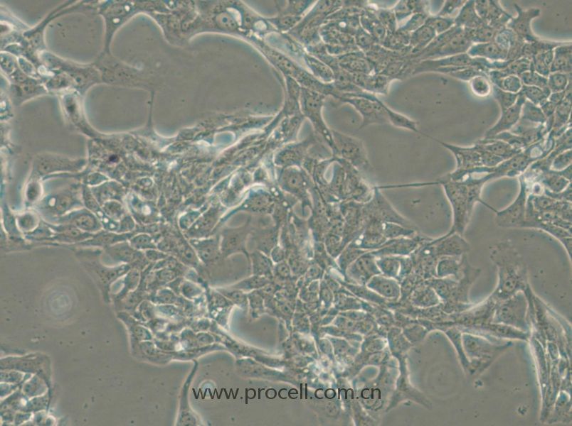 HCC70 (人乳腺导管癌细胞) (STR鉴定正确)