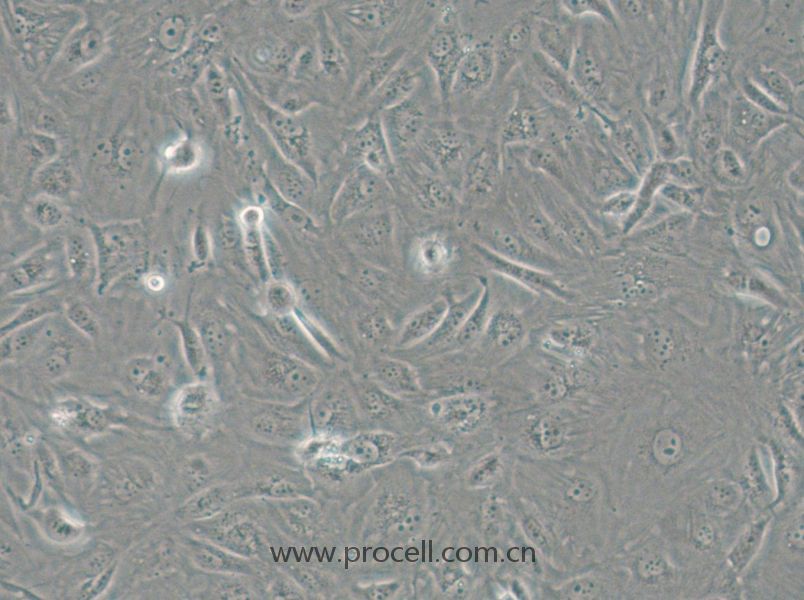 SW1710 (人膀胱癌细胞) (STR鉴定正确)