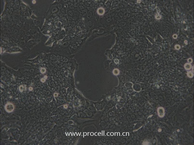 SW1417 (人结肠直肠腺癌细胞) (STR鉴定正确)