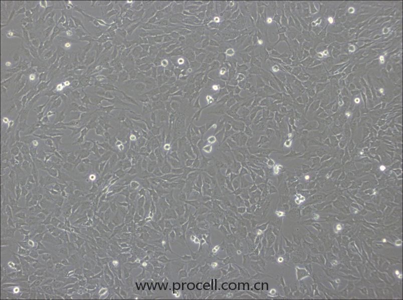 hCMEC/D3 (人脑微血管内皮细胞) (STR鉴定正确)