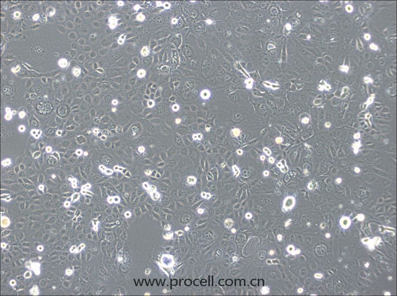 SVCT (人乳腺上皮细胞) (STR鉴定正确)