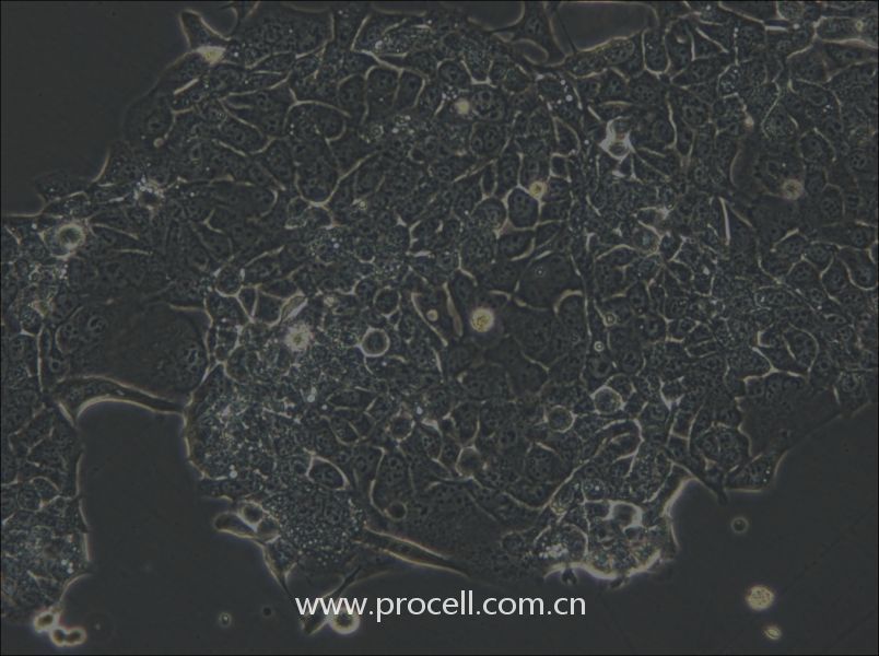 OE33 (人食管腺癌细胞) (STR鉴定正确)