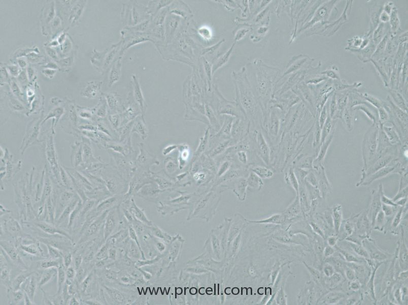 NRK-49F (大鼠正常肾成纤维细胞) (种属鉴定正确)