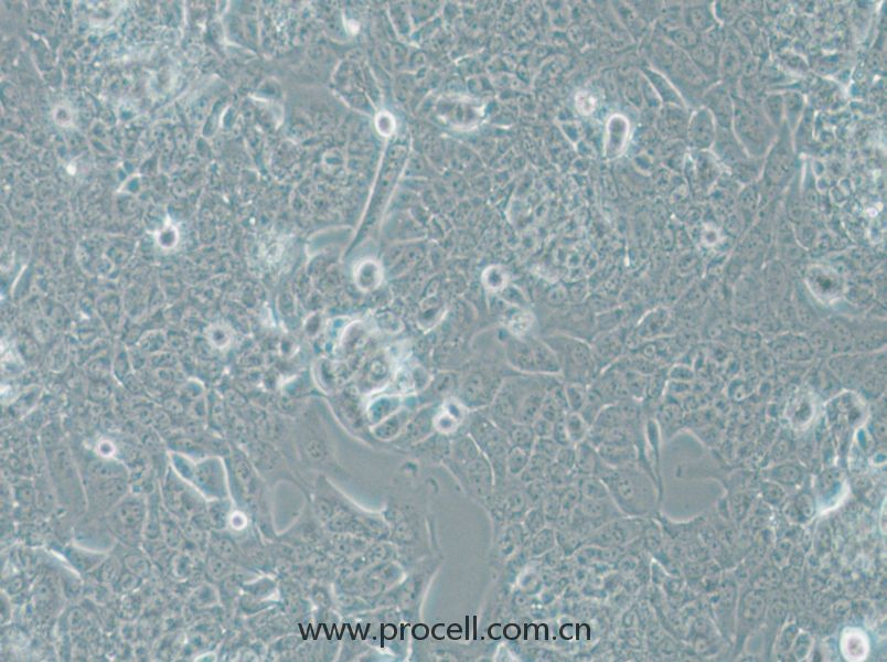 NCI-H1793 (人肺癌细胞) (STR鉴定正确)