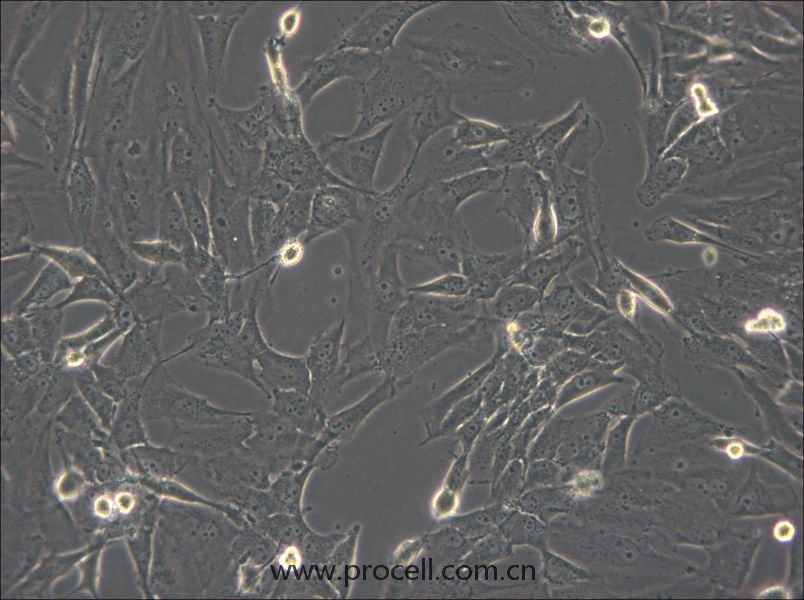 SW1783  (人脑星形胶质细胞瘤细胞) (STR鉴定正确)