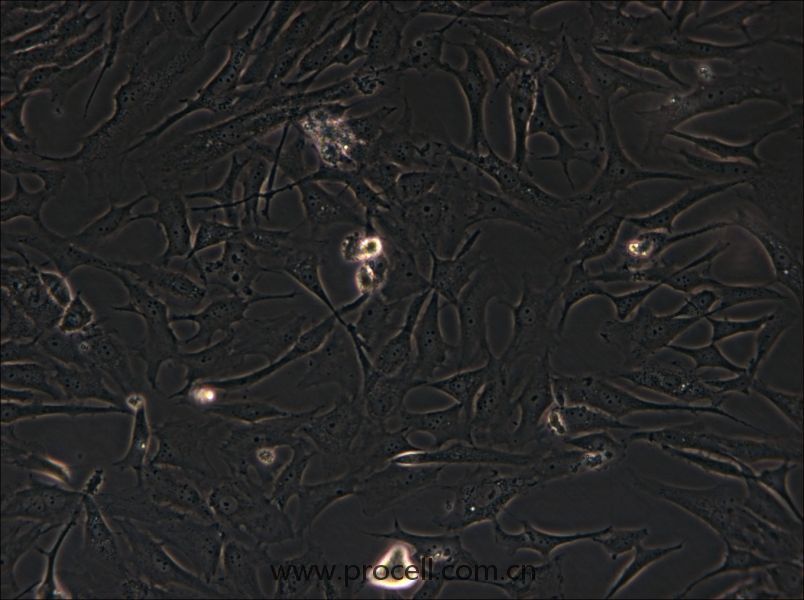 HS-27A (人骨髓细胞) (STR鉴定正确)