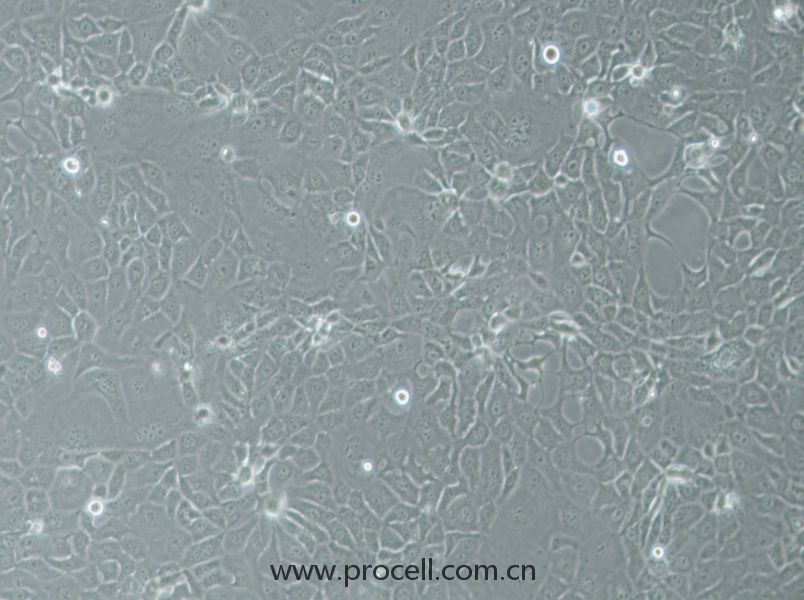 HCC-78 (人肺腺癌细胞) (STR鉴定正确)