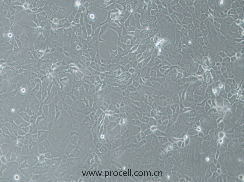 HCC-78 (人肺腺癌细胞) (STR鉴定正确)