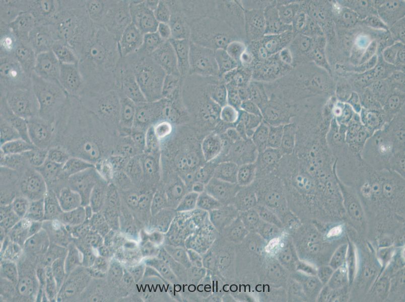 HCC-78 (人肺腺癌细胞) (STR鉴定正确)