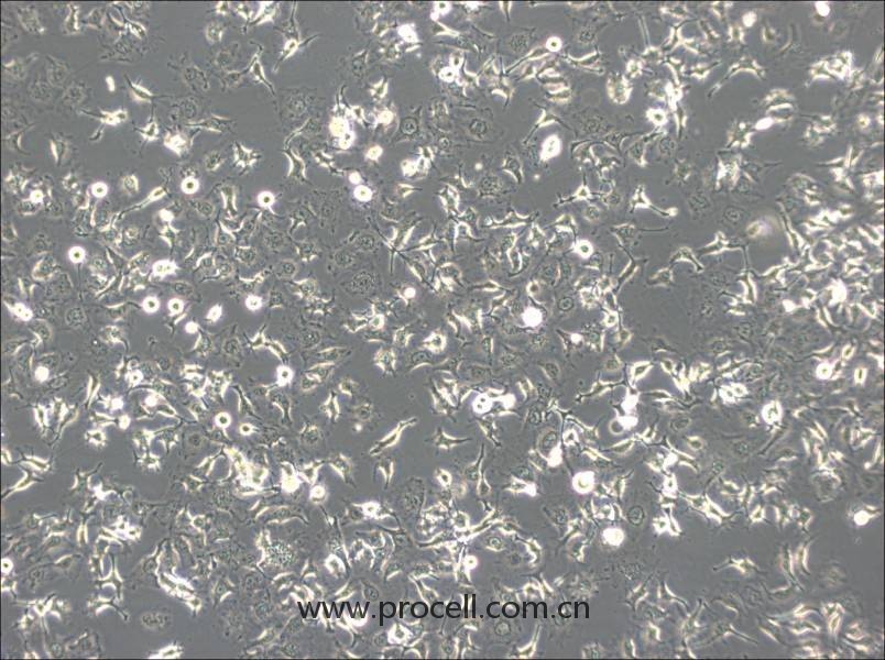 HCC1588(人肺鳞癌细胞) (STR鉴定正确)