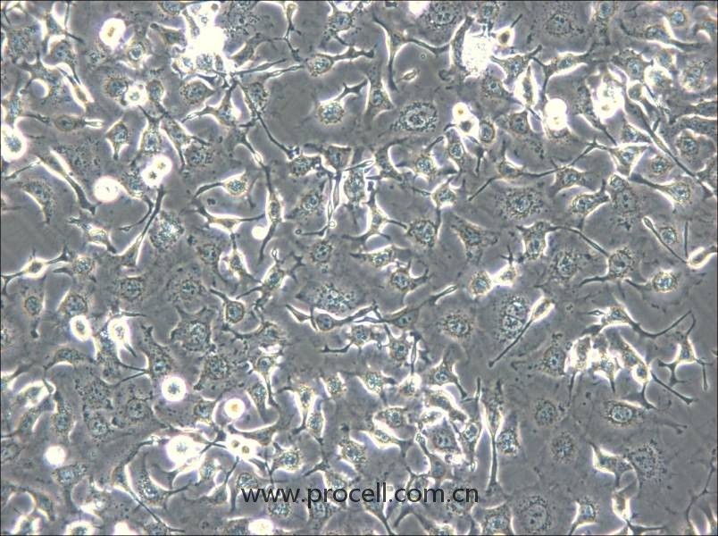 HCC1588(人肺鳞癌细胞) (STR鉴定正确)