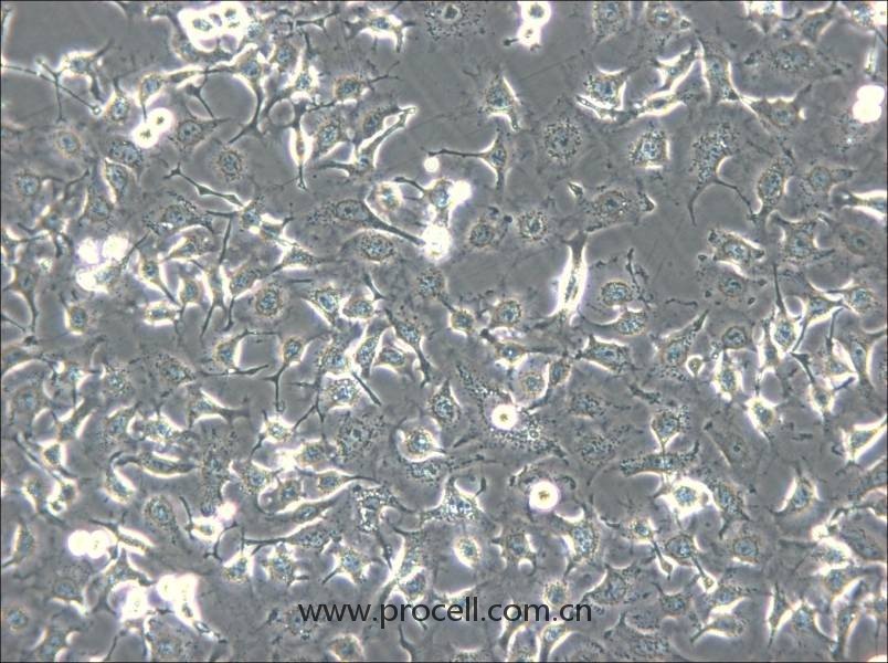 HCC1588(人肺鳞癌细胞) (STR鉴定正确)