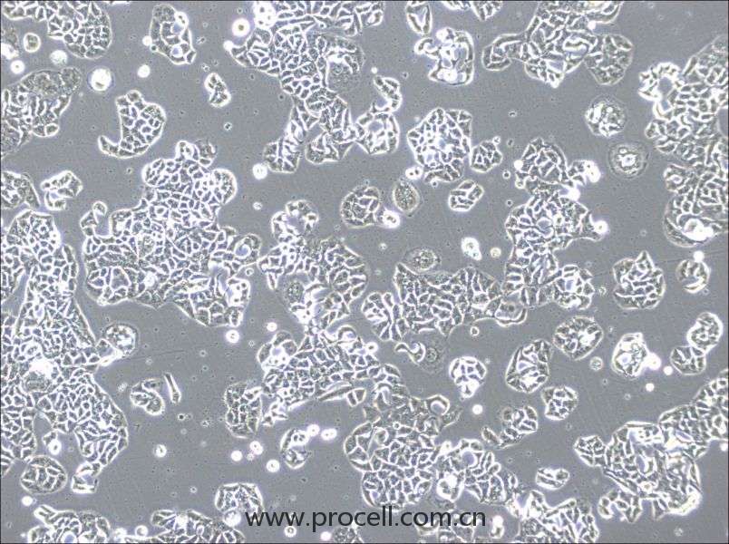 HCC1833 (人肺癌腺癌细胞) (STR鉴定正确)