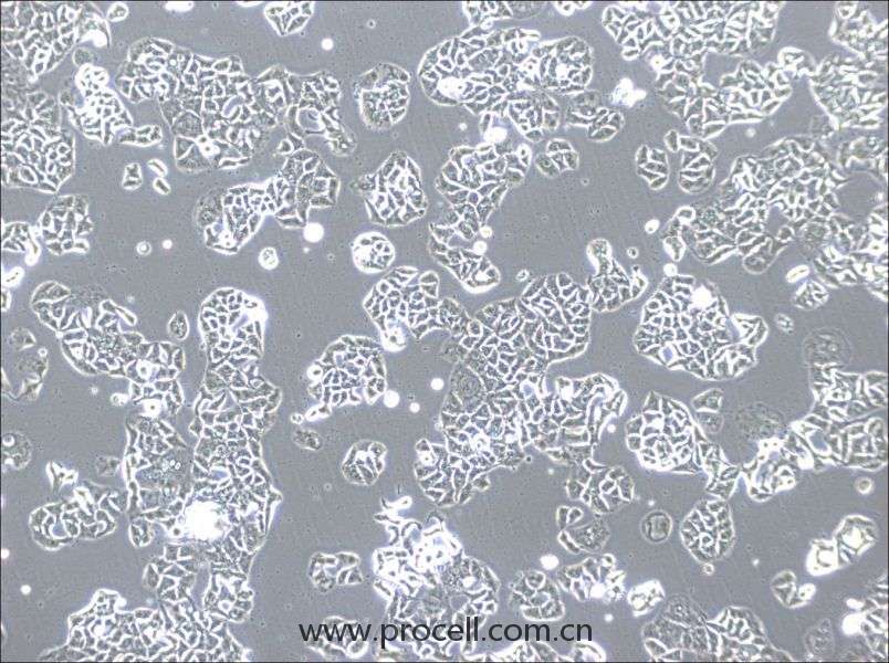 HCC1833 (人肺癌腺癌细胞) (STR鉴定正确)