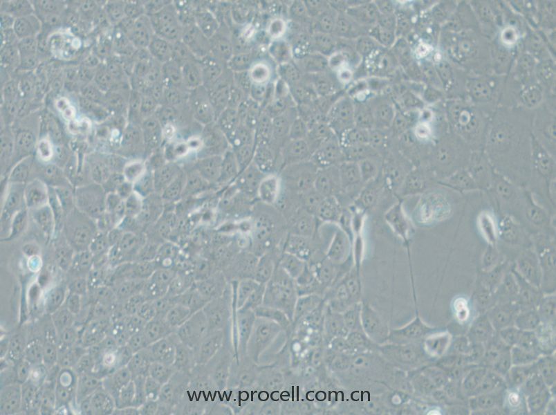 UM-SCC-1 (人口底鳞癌细胞) (STR鉴定正确)