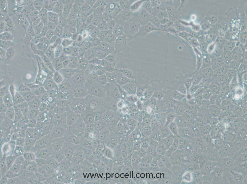 UM-SCC-1 (人口底鳞癌细胞) (STR鉴定正确)