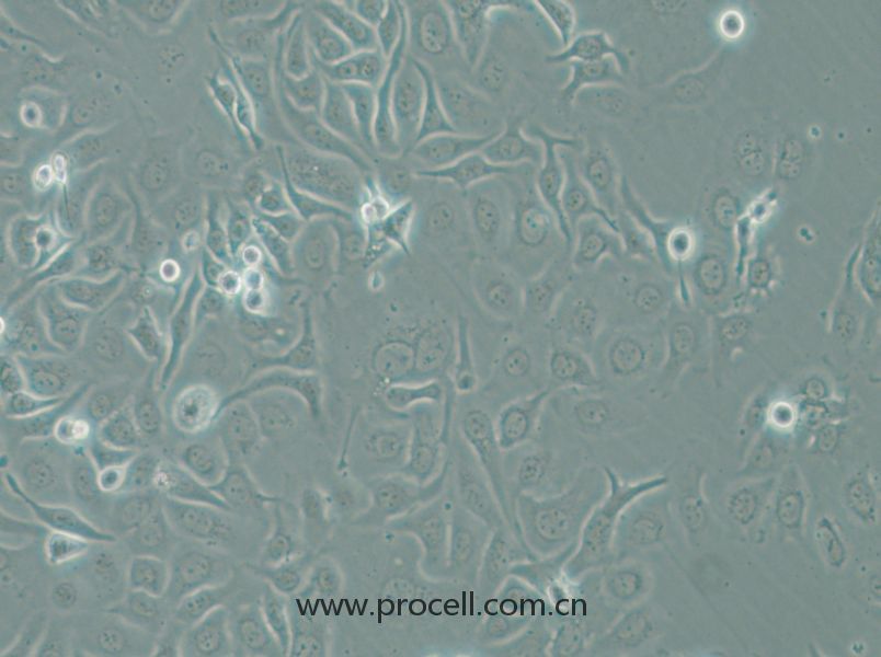 HCC1143 (人乳腺癌细胞) (STR鉴定正确)