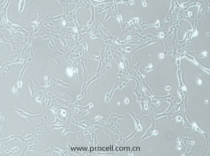 HLE-B3 (人晶状体上皮细胞) (STR鉴定正确)