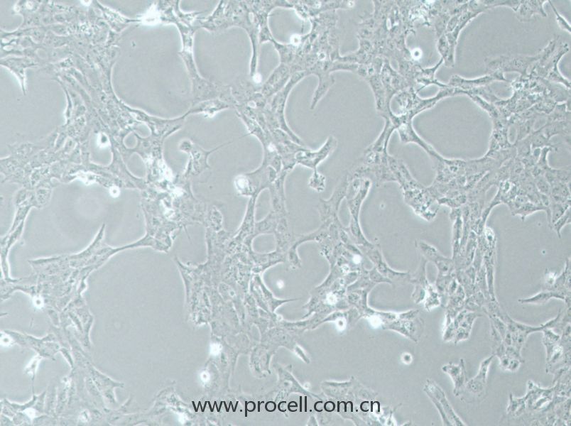 HLE-B3 (人晶状体上皮细胞) (STR鉴定正确)