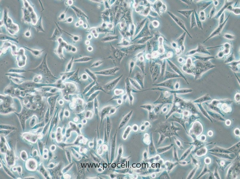 NCI-H1993 (人非小细胞肺癌腺癌细胞) (STR鉴定正确)