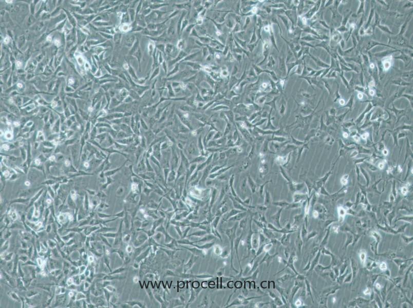 MiCl1 (S+L-) (水貂肺成纤维细胞)