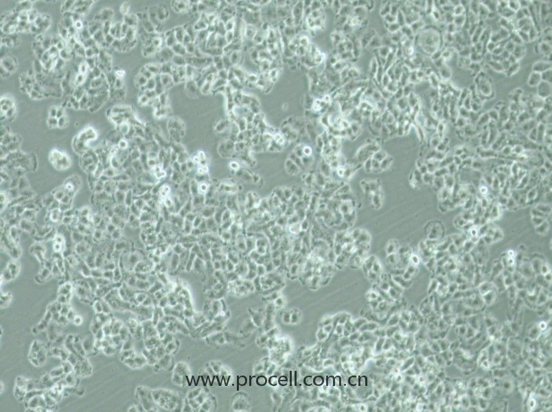 QGP-1 (人胰腺癌细胞) (STR鉴定正确)