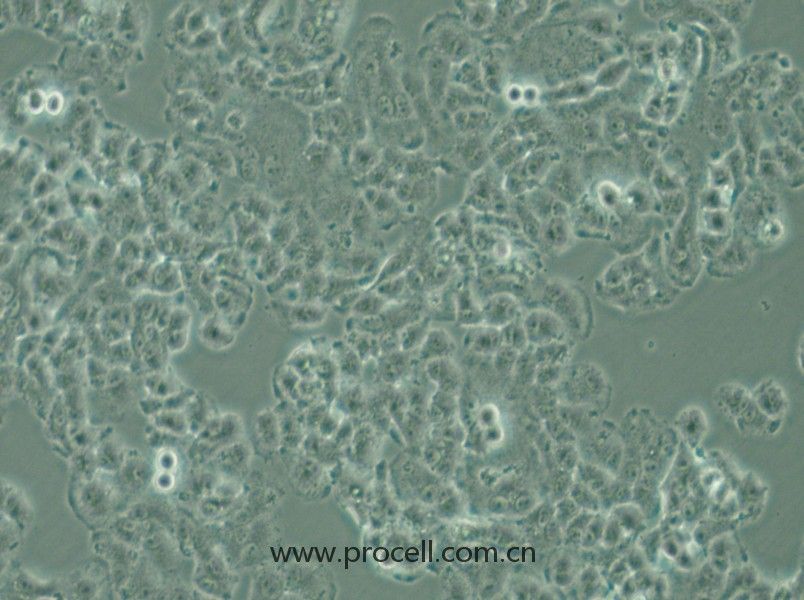 QGP-1 (人胰腺癌细胞) (STR鉴定正确)